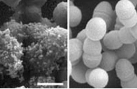 03 Rheumatische Herzkrankheit