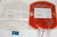 23 Steriles Beutelsystem