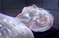 Strahlentherapie mit Ionen