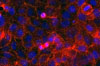 MDC Turmor COLON CARCINOM 1 Fritzmann 11x66
