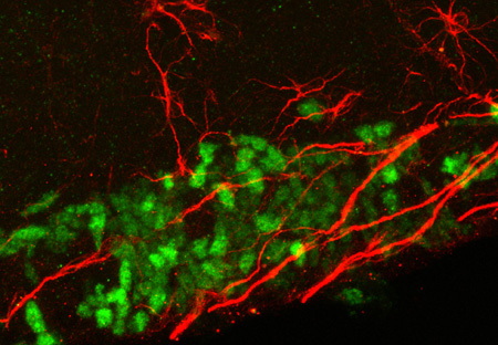 Die Forschung ist auch auf embryonale Stammzellen angewiesen (im Bild adulte Stammzellen). Bild: Helmholtz-Zentrum München