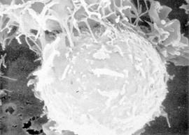 Von oben links greift eine so genannte Killerzelle eine Krebszelle an. Bild: DKFZ/Peter H. Krammer