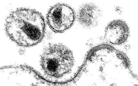 Elektronenmikroskopische Aufnahme von Aidsviren an der Membran einer Zelle. Bild: Hanswalter Zentgraf/ DKFZ
