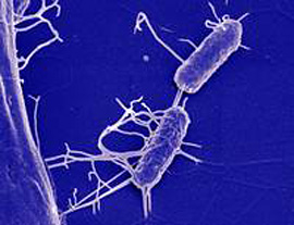 Zellen von Salmonella typhimurium. Bild: Manfred Rohde/HZI