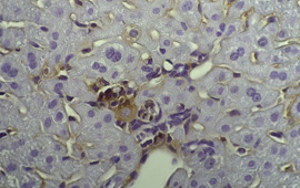 Lebergewebeschnitt mit einer seneszenten Leberzelle genau in der Bildmitte. Bild: HZI