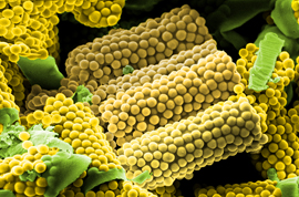 Dieser Nano-Wirkstofftransporter für Medikamente erinnert an Mais. Für die Rasterelektronenmikroskop-Aufnahme erhielten Wissenschaftler des Helmholtz-Zentrums für Infektionsforschung und der...