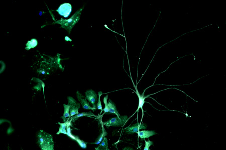 Glial cells were isolated from a patients cerebral cortex and in cell culture converted into functional neurons (here: nerve cell with long dendrites).   Photo: Karow et al., Cell Stem Cell 2012