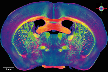 Nervenfaserverläufe in Mausgehirnen, dargestellt mit der Methode des Polarized Light Imaging.  Bild: Amunts, Zilles, Axer et. al./Forschungszentrum Jülich