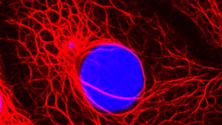 photo breast cancer cell