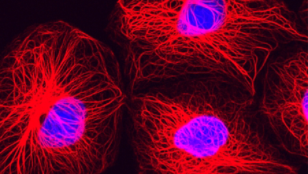 photo breast cancer cells