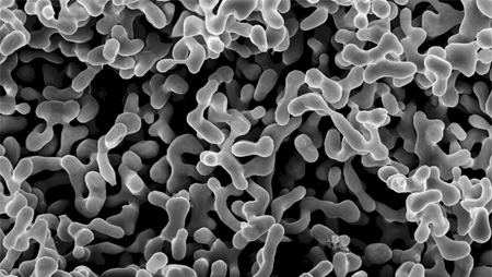 Poren unter Rasterelektronenmikroskop