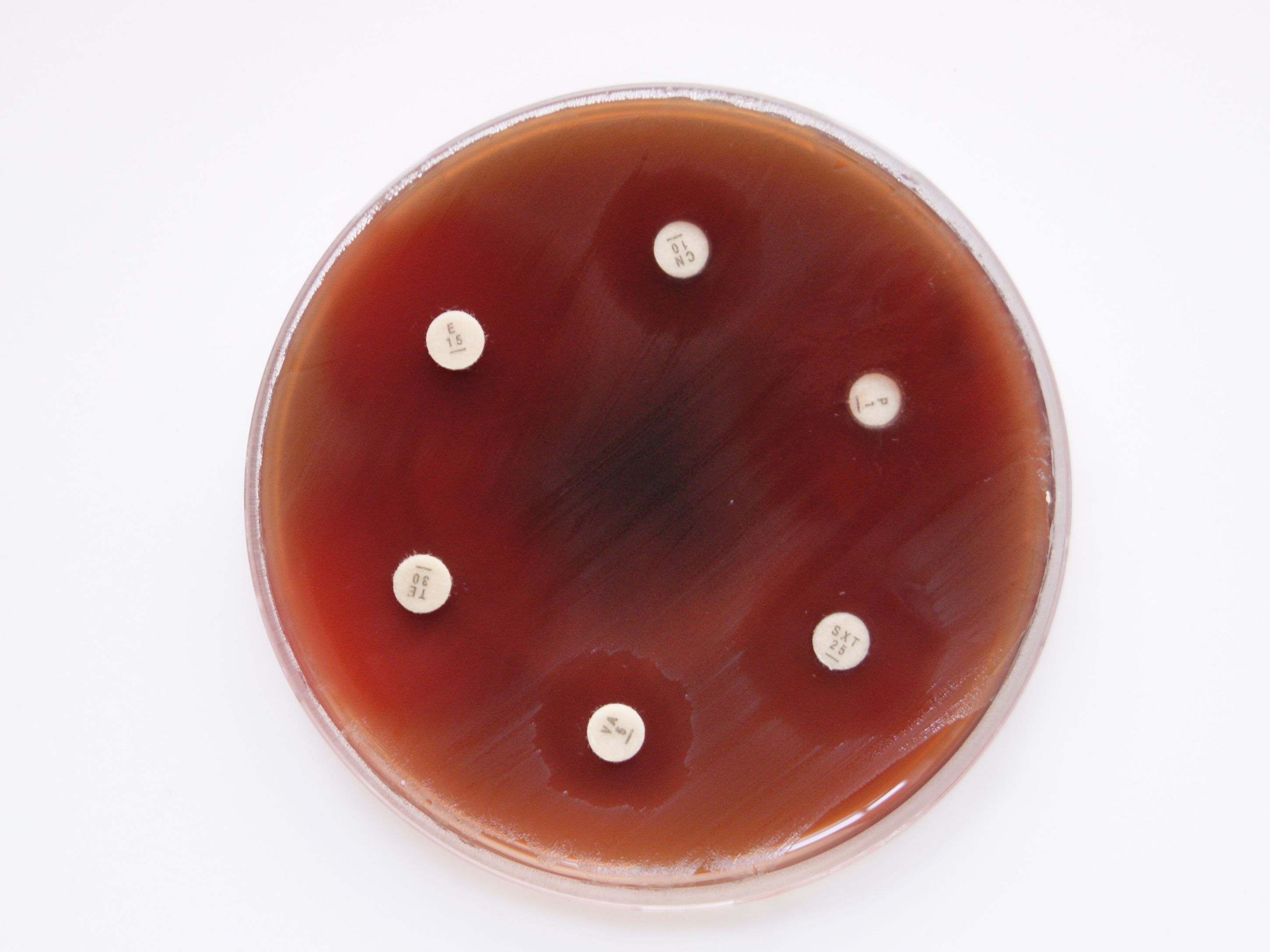 "AI will be a gamechanger in antibiotics research"