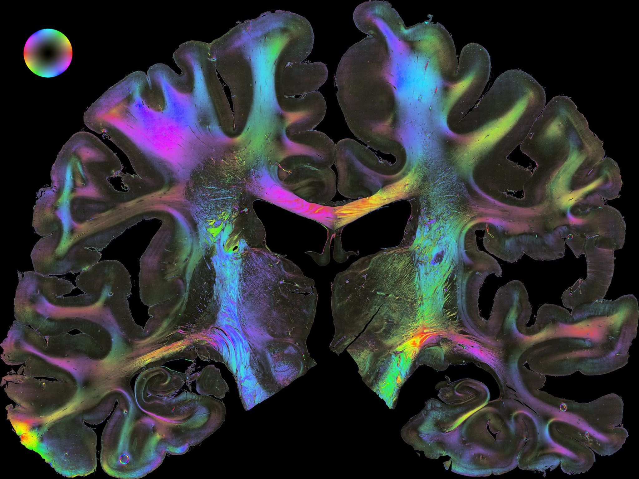 "A key for further brain research"