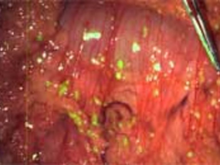 ESP Schroedingerpreis2011 hmgu 200x130