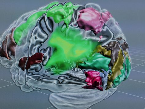 Can brain scans detect political attitudes?