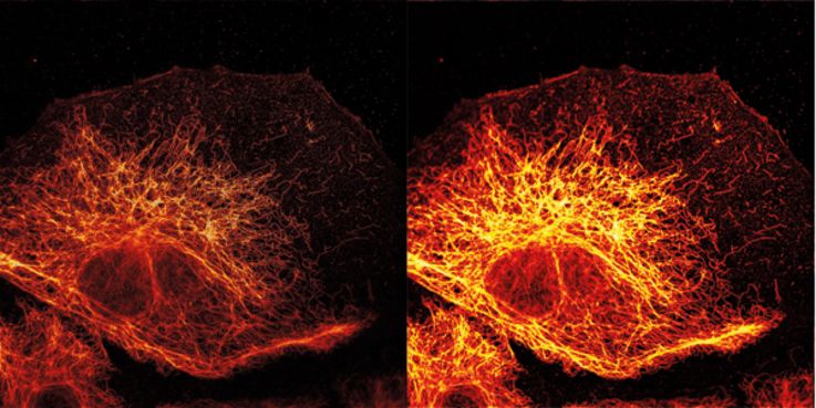 STED-Mikroskopie Das linke Bild zeigt feinste Fasern des Zellskeletts (Vimentin) und wurde mit der STED-Mikroskopie aufgenommen; zum Vergleich rechts die gleiche Struktur mit einer konventionellen Technik, der konfokalen Mikroskopie. Bild: DKFZ